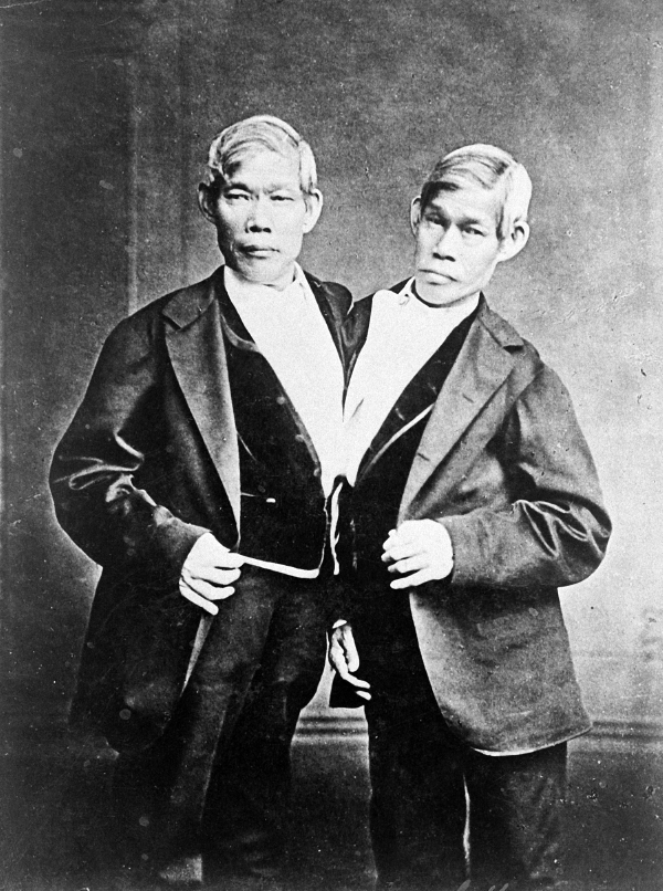 Chang (right) and Eng Bunker were born in Thailand in 1811 and became famous as the “Siamese Twins.”