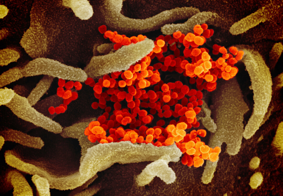 SARS-CoV-2, the virus that causes COVID-19, is shown in orange in cells cultured in a lab. (Source: National Institutes of Health)
