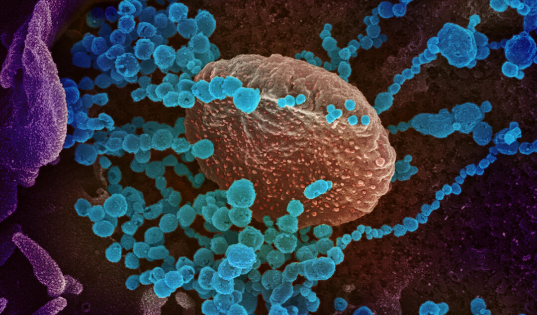 This scanning electron microscope image shows SARSCoV-2 (round blue objects) emerging from the surface of cells cultured in the lab. (Source: NIAID CC BY 2.0)